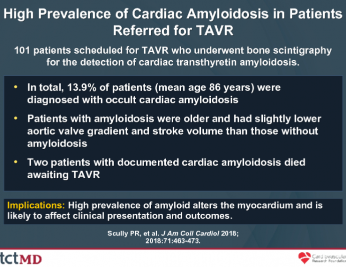 High Prevalence of Cardiac Amyloidosis in Patients Referred for TAVR