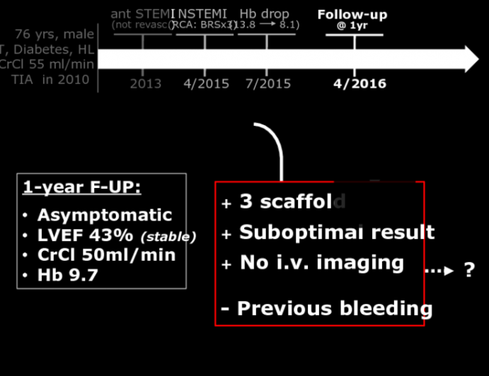 Case: 1-year F-UP, Asymptomatic LVEF 43% (stable)