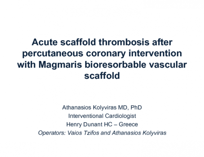 Acute scaffold thrombosis after percutaneous coronary intervention with Magmaris bioresorbable vascular scaffold