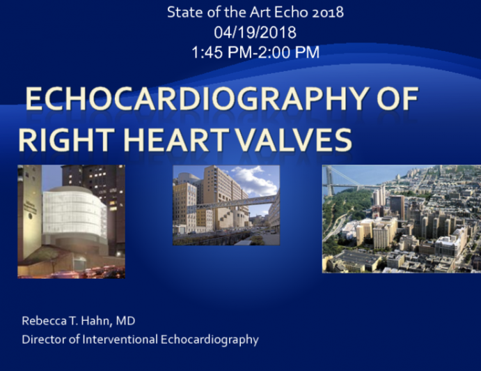 Echocardiography of Right Heart Valves