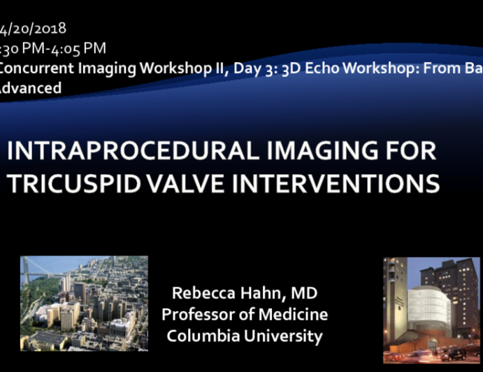 Intraprocedural Imaging For Tricuspid Valve Interventions