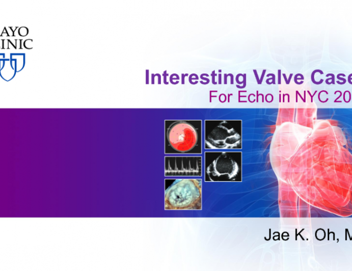 Interesting Valve Cases: For Echo in NYC 2018