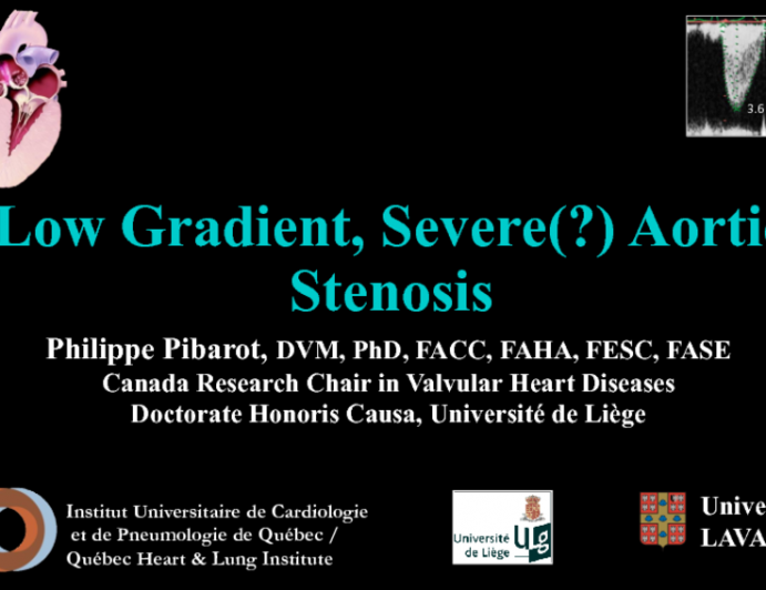 Low Gradient, Severe(?) Aortic Stenosis