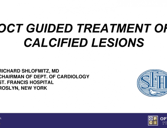 OCT Guided Treatment of Calcified Lesions