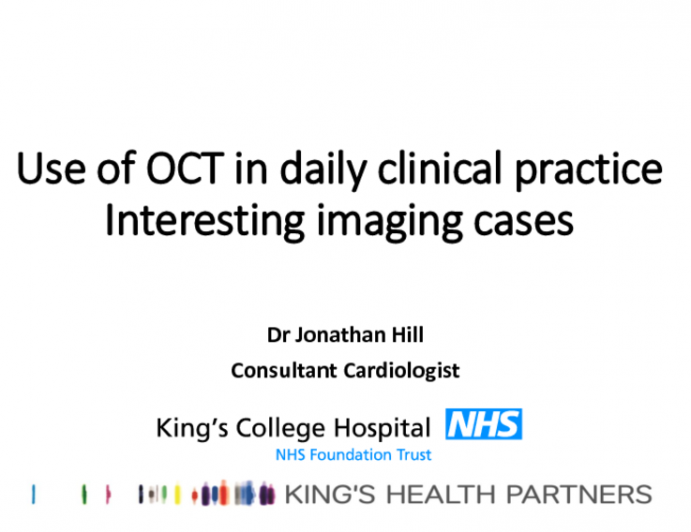 Use of OCT in daily clinical practice Interesting imaging cases