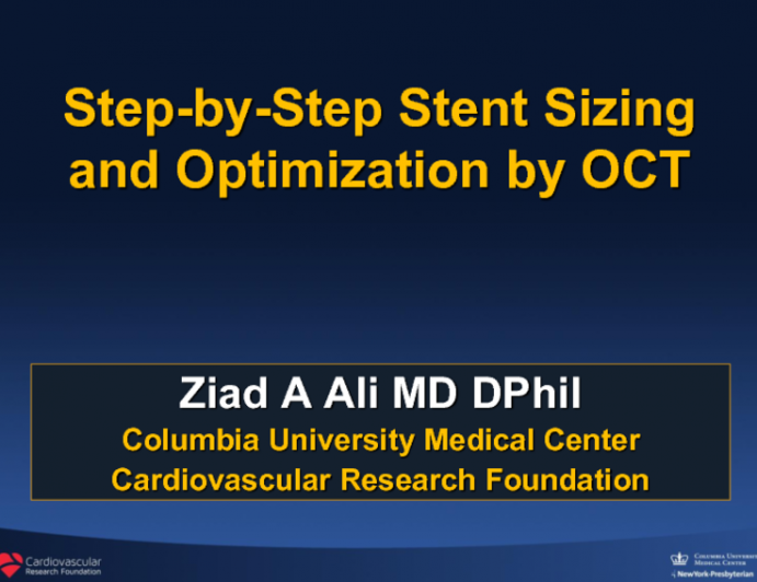 Step-by-Step Stent Sizing and Optimization by OCT
