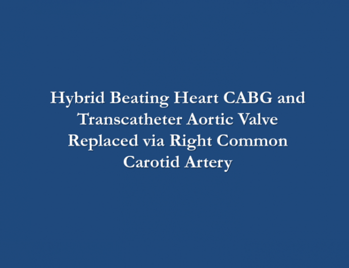 Hybrid Beating Coronary Artery Bypass Grafting and Transcatheter Aortic Valve Replacement via Right Carotid Artery Access in a Patient With Severe Peripheral Arterial Disease