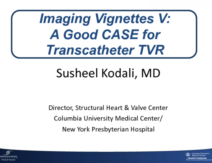 Imaging Vignettes V: A Good CASE for Transcatheter TVR