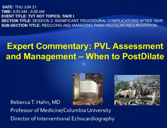 Expert Commentary: PVL Assessment and Management – When to Postdilate