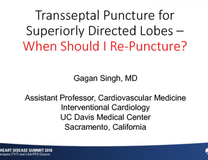 Trans-septal Puncture for Superiorly Directed Lobes