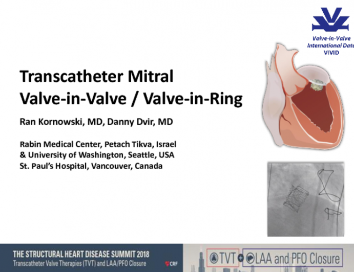 Mitral Valve-in … Valve and Ring I: Insights From the VIVID Registry