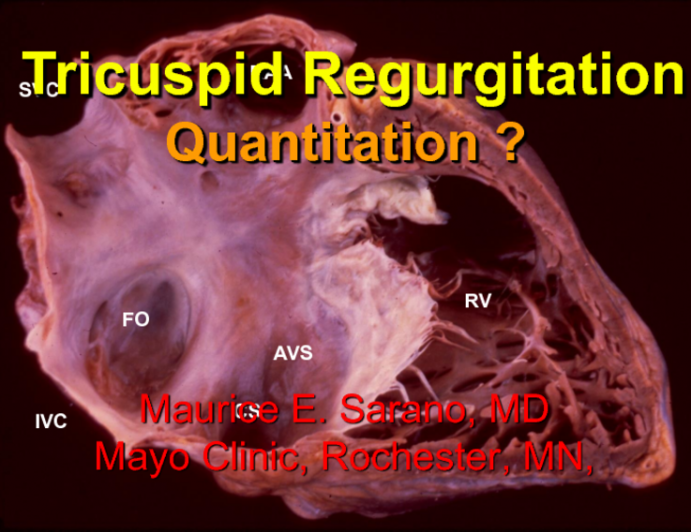 Imaging Vignettes I: Echo Quantitative Assessment of TR Severity