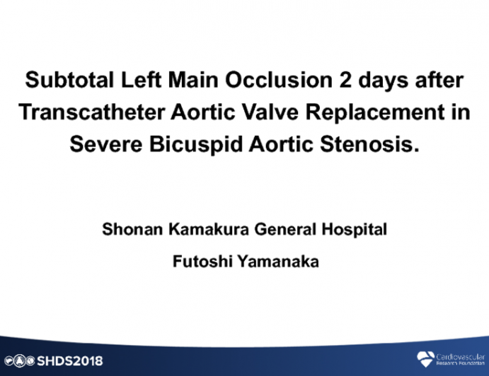 Subtotal Left Main Occlusion Two Days After Transcatheter Aortic Valve Replacement in Severe Bicuspid Aortic Stenosis