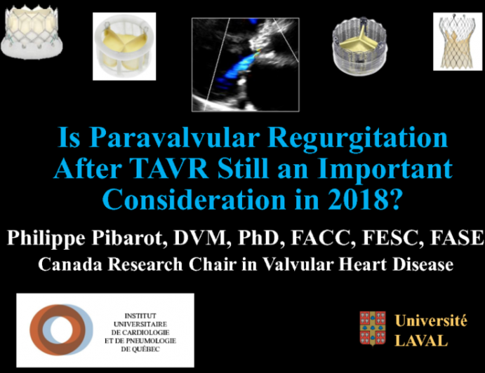 Is Paravalvular Regurgitation After TAVR Still an Important Consideration in 2018?