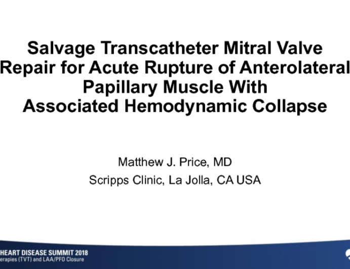 Salvage Transcatheter Mitral Valve Repair for Acute Rupture of Anterolateral Papillary Muscle With Associated Hemodynamic Collapse