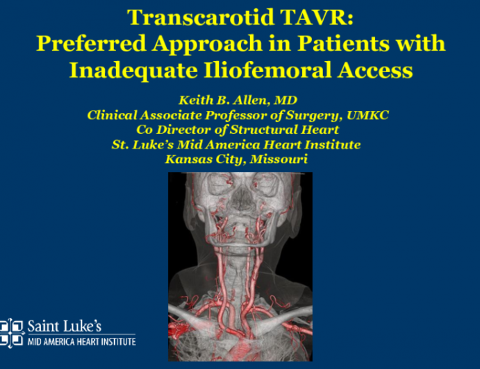 Transcarotid Is My Preferred Alternative Access for TAVR