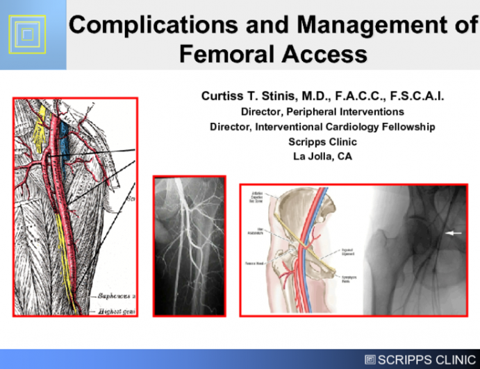 Complications and Management of Femoral Access