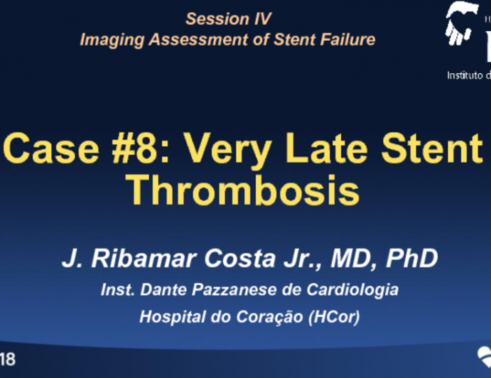 Case #8: Very Late Stent Thrombosis