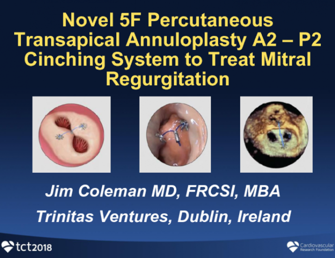 Novel 5F Percutaneous Transapical Annuloplasty A2–P2 Cinching System to Treat Mitral Regurgitation (Trinitas)