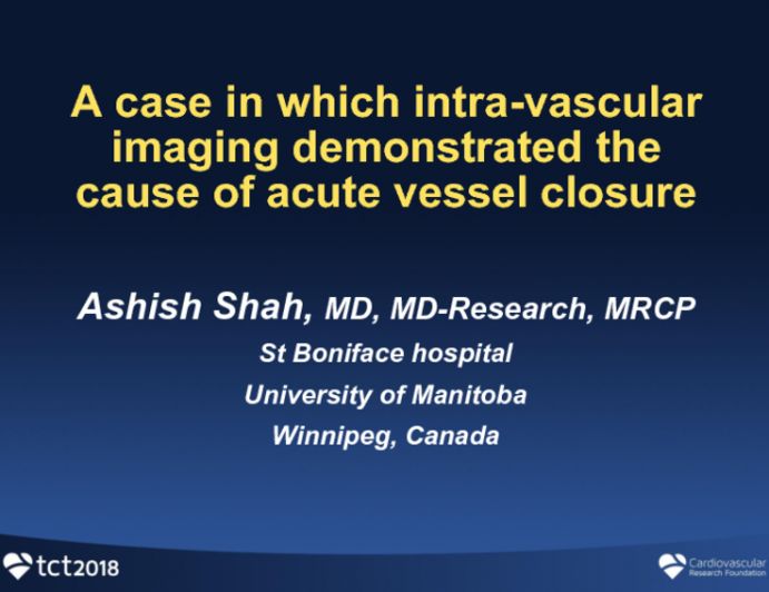 Case #11: A Case in Which Intravascular Imaging Demonstrated the Cause of Acute Vessel Closure