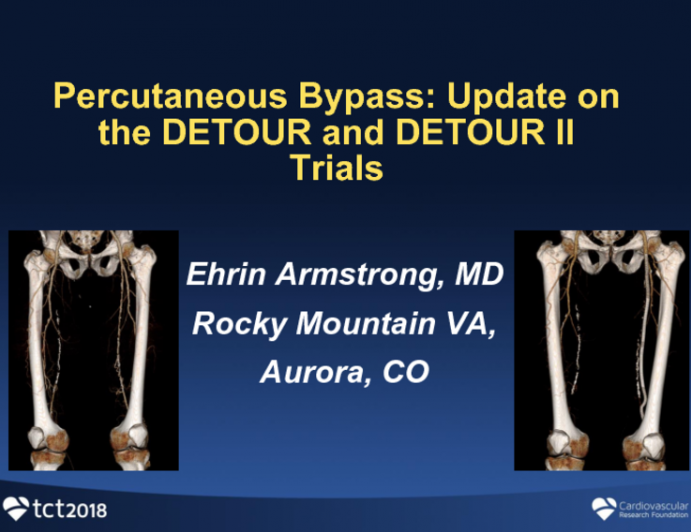 Percutaneous Bypass: Update on the DETOUR and DETOUR II Trials