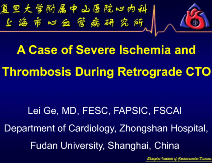 Case #7: A Case of Severe Ischemia and Thrombosis During Retrograde CTO