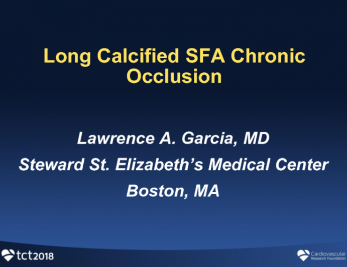 Long Calcified SFA Chronic Occlusion