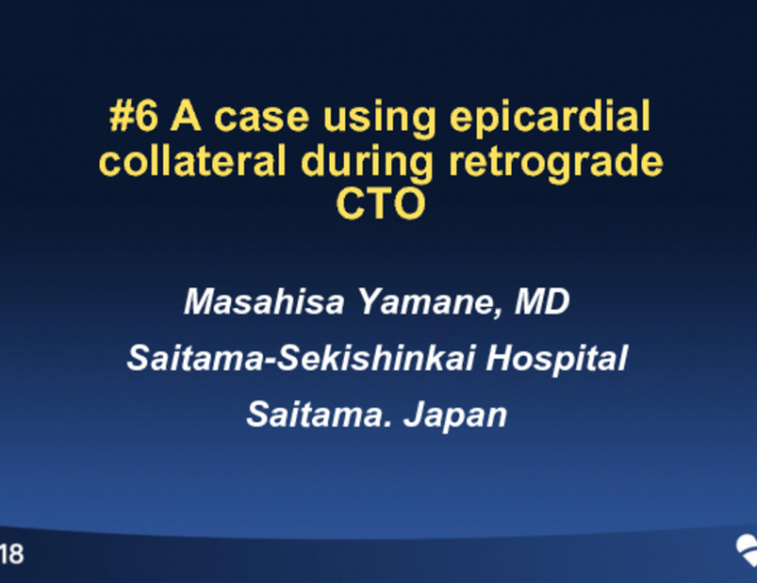 Case #5: A Case Using Epicardial Collaterals During Retrograde CTO