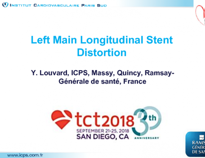 Left Main Longitudinal Stent Distortion