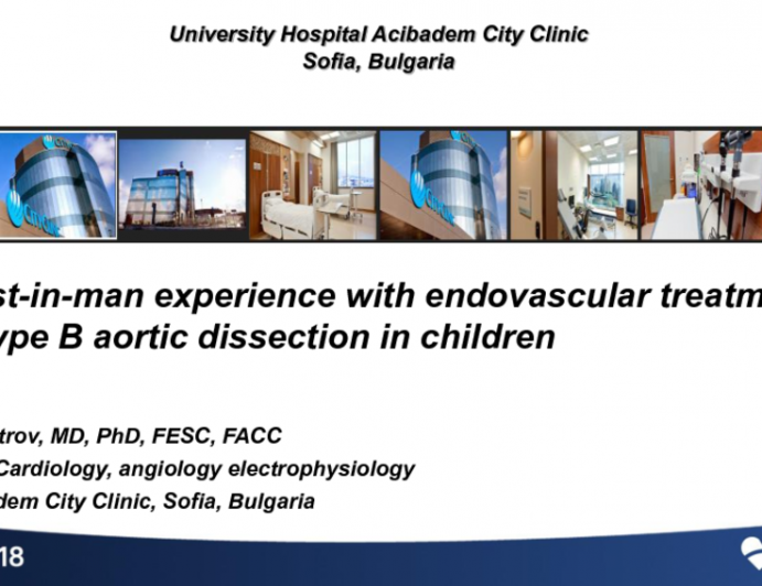 Bulgaria Presents: First-In-Human Experience With Endovascular Treatment Of Aortic Dissection Type B In Childhood