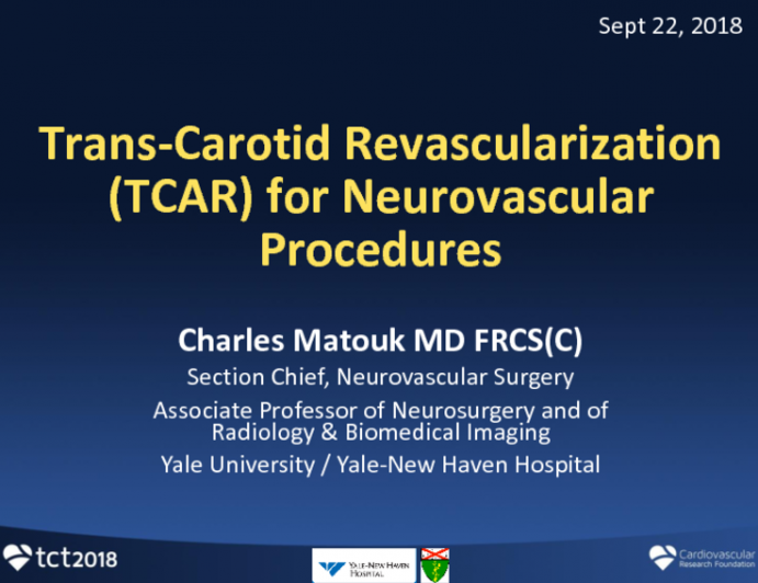 Case #6: Trans-Cervical Carotid Artery Stenting: Silk-Road