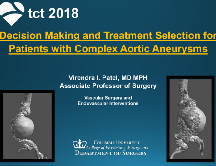 Decision-making and Treatment Selection for Patients With Complex Abdominal Aortic Aneurysms