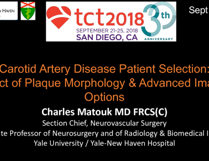 Carotid Artery Disease Patient Selection: Impact of Plaque Morphology and Advanced Imaging Options