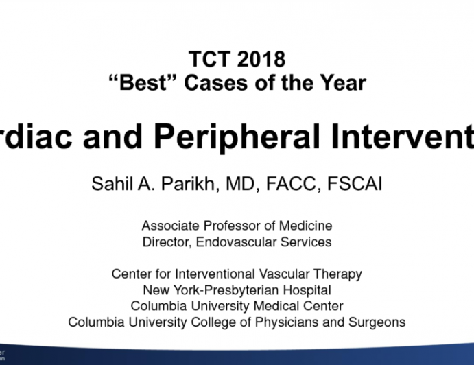 My Best Case – Combined Coronary and Peripheral Intervention
