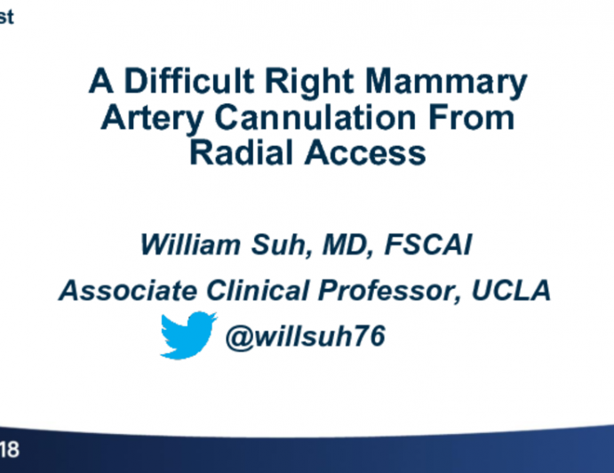 Case #9: A Difficult Right Mammary Artery Cannulation From Radial Access