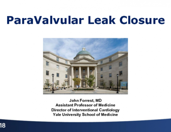 Case #2: A Case of Paravalvular Leak Post-TAVR