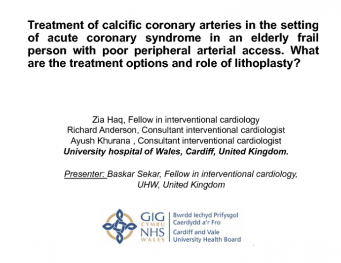 Case 4 (D): Treatment Of Calcific Coronary Arteries In The Setting Of Acute Coronary Syndrome In An Elderly Frail Person With Poor Peripheral Arterial Access