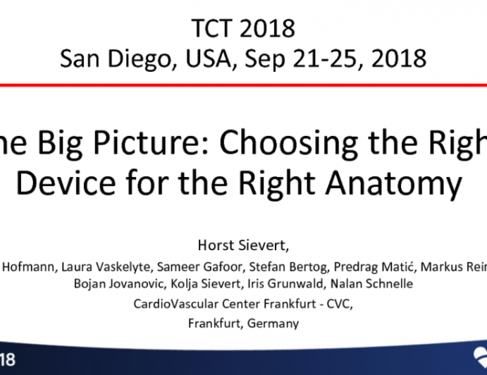 The Big Picture: Choosing the Right Device for the Right Anatomy