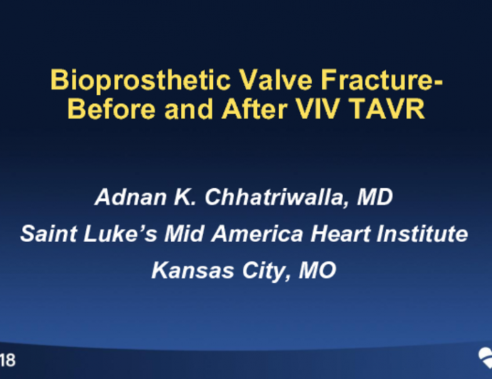 Case #4: Bioprosthetic Valve Fracture - Before or After TAVR ViV?