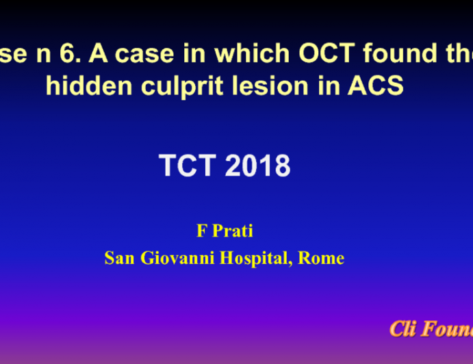 Case #6: A Case in Which OCT “Found” the Hidden Culprit Lesion in ACS