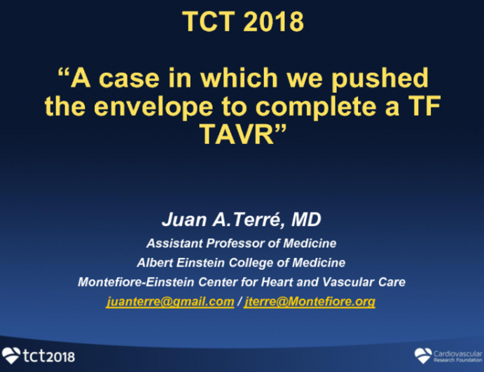 Case #5: A Case in Which We “Pushed the Envelope” to Complete a Transfemoral TAVR