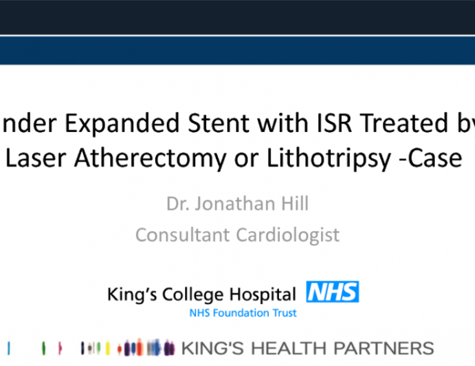 Case #9: Under-Expanded Stent with ISR Treated by Laser, Atherectomy, or Lithotripsy
