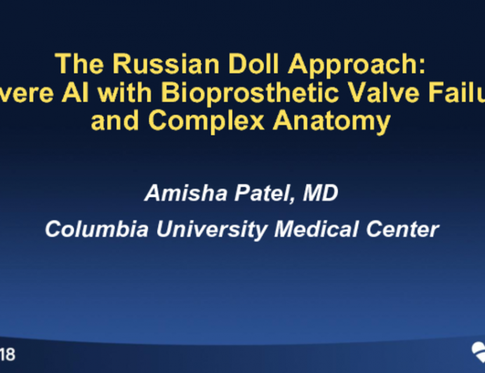 #6 The Russian Doll Approach… Severe AS/AR With Bioprosthetic Valve Failure and “Complex” Anatomy - Case Presentation