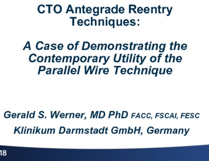 Case #1: A Case of Demonstrating the Contemporary Utility of the Parallel Wire Technique