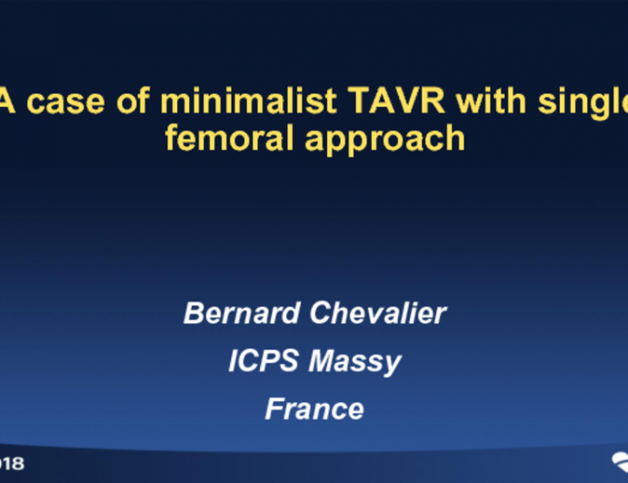 Case #4: A Case of Minimalist TAVR With Single Femoral Access