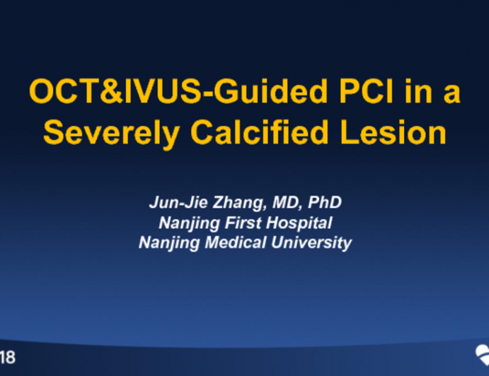 Case #3: OCT-Guided PCI in a Severely Calcified Lesion