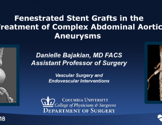 Fenestrated Stent Grafts in the Treatment of Complex Abdominal Aortic Aneurysms