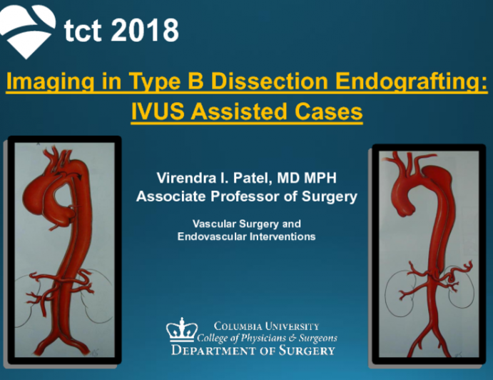 Imaging in Type B Dissection Endografting: IVUS Assisted Techniques (With Case Examples)