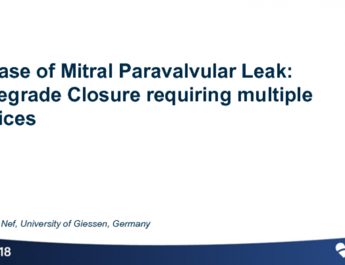 Case #3: A Case of Mitral Paravalvular Leak: Antegrade Closure Requiring Multiple Devices