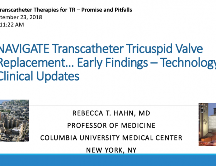 NAVIGATE Transcatheter Tricuspid Valve Replacement… Early Findings – Technology and Clinical Updates